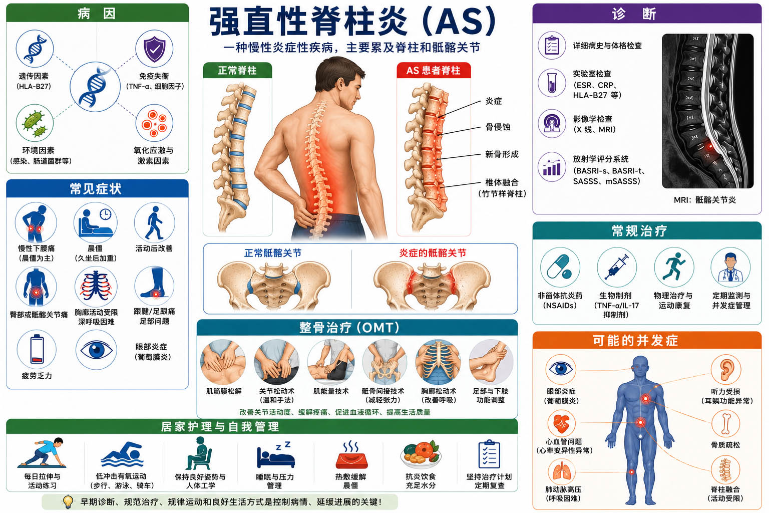 Anklosing Spondilitis Ch